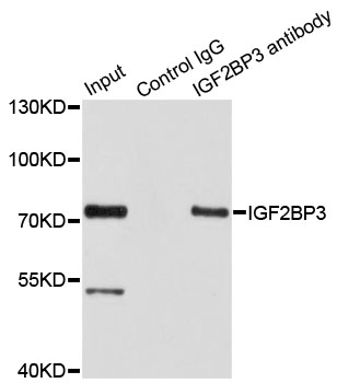IMP-3 / IGF2BP3 Antibody - Immunoprecipitation analysis of 100ug extracts of HepG2 cells.