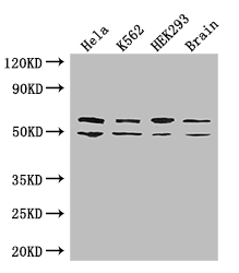 IMP-3 / IGF2BP3 Antibody - Positive WB detected in:Hela whole cell lysate,K562 whole cell lysate,HEK293 whole cell lysate,Mouse brain tissue;All lanes: IGF2BP3 antibody at 2ug/ml;Secondary;Goat polyclonal to rabbit IgG at 1/50000 dilution;Predicted band size: 64,22 kDa;Observed band size: 64,50 kDa;