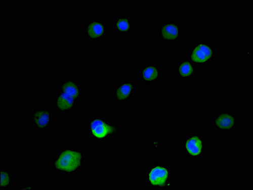 IMP-3 / IGF2BP3 Antibody - Immunofluorescent analysis of MCF-7 cells using IGF2BP3 Antibody at a dilution of 1:100 and Alexa Fluor 488-congugated AffiniPure Goat Anti-Rabbit IgG(H+L)