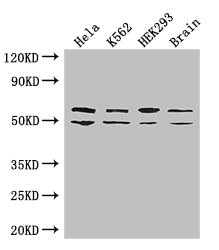 IMP-3 / IGF2BP3 Antibody - Western Blot Positive WB detected in: Hela whole cell lysate, K562 whole cell lysate, HEK293 whole cell lysate, Mouse brain tissue All lanes: IGF2BP3 antibody at 2µg/ml Secondary Goat polyclonal to rabbit IgG at 1/50000 dilution Predicted band size: 64, 22 kDa Observed band size: 64, 50 kDa