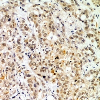 IMP-3 / IGF2BP3 Antibody