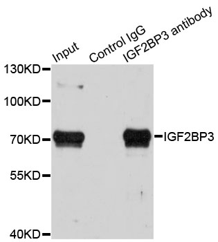 IMP-3 / IGF2BP3 Antibody - Immunoprecipitation analysis of 100ug extracts of HepG2 cells using 3ug IGF2BP3 antibody. Western blot was performed from the immunoprecipitate using IGF2BP3 antibody at a dilition of 1:1000.