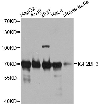 IMP-3 / IGF2BP3 Antibody - Western blot analysis of extracts of various cell lines, using IGF2BP3 antibody at 1:1000 dilution. The secondary antibody used was an HRP Goat Anti-Rabbit IgG (H+L) at 1:10000 dilution. Lysates were loaded 25ug per lane and 3% nonfat dry milk in TBST was used for blocking. An ECL Kit was used for detection and the exposure time was 15s.