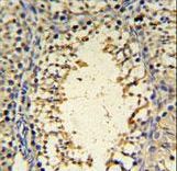 IMP3 Antibody - IMP3 Antibody IHC of formalin-fixed and paraffin-embedded mouse testis tissue followed by peroxidase-conjugated secondary antibody and DAB staining.