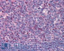 IMP3 Antibody - Anti-IMP3 antibody IHC of human tonsil. Immunohistochemistry of formalin-fixed, paraffin-embedded tissue after heat-induced antigen retrieval. Antibody concentration 5 ug/ml.  This image was taken for the unconjugated form of this product. Other forms have not been tested.