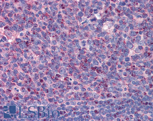 IMP3 Antibody - Anti-IMP3 antibody IHC of human tonsil. Immunohistochemistry of formalin-fixed, paraffin-embedded tissue after heat-induced antigen retrieval. Antibody concentration 5 ug/ml.  This image was taken for the unconjugated form of this product. Other forms have not been tested.