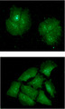 IMP3 Antibody - ICC/IF analysis of IMP3 in Hep3B cells line, stained with DAPI (Blue) for nucleus staining and monoclonal anti-human IMP3 antibody (1:100) with goat anti-mouse IgG-Alexa fluor 488 conjugate (Green).ICC/IF analysis of IMP3 in Hep3B cells line, stained with DAPI (Blue) for nucleus staining and monoclonal anti-human IMP3 antibody (1:100) with goat anti-mouse IgG-Alexa fluor 488 conjugate (Green).