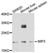 IMP3 Antibody - Western blot analysis of extract of various cells.