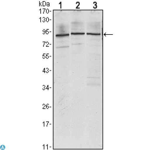 IMP3 Antibody - Western Blot (WB) analysis using IMP-3 Monoclonal Antibody against Jurkat (1), K562 (2) and NTERA-2 (3) cell lysate.