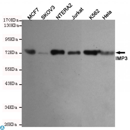 IMP3 Antibody - Western blot detection of IMP3 in MCF7, SKVO3, NTERA2, Jurkat, Hela and K562 cell lysates using IMP3 mouse mAb (1:1000 diluted). Predicted band size: 70KDa. Observed band size: 70KDa.