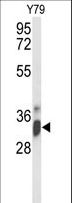 IMP4 Antibody - Western blot of IMP4 Antibody in Y79 cell line lysates (35 ug/lane). IMP4 (arrow) was detected using the purified antibody.