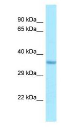IMP4 Antibody - IMP4 / BXDC4 antibody Western Blot of HepG2.  This image was taken for the unconjugated form of this product. Other forms have not been tested.