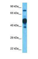 IMP5 Antibody - Western blot of SPPL2C Antibody with human Ovary Tumor lysate.  This image was taken for the unconjugated form of this product. Other forms have not been tested.
