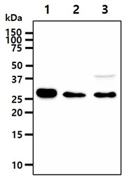 IMPA1 / IMP Antibody - The cell lysates (40ug) were resolved by SDS-PAGE, transferred to PVDF membrane and probed with anti-human IMPA1 antibody (1:1000). Proteins were visualized using a goat anti-mouse secondary antibody conjugated to HRP and an ECL detection system. Lane 1.: Jurkat cell lysate Lane 2.: Raji cell lysate Lane 3.: NIH/3T3 cell lysate