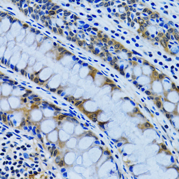 IMPA1 / IMP Antibody - Immunohistochemistry of paraffin-embedded human colon tissue.