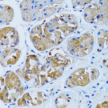 IMPA1 / IMP Antibody - Immunohistochemistry of paraffin-embedded human stomach tissue.