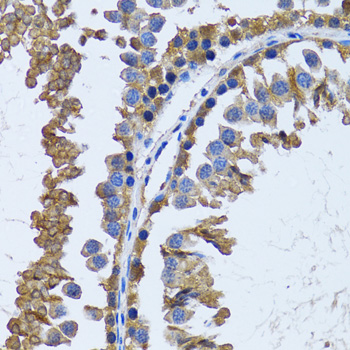 IMPA1 / IMP Antibody - Immunohistochemistry of paraffin-embedded mouse testis tissue.