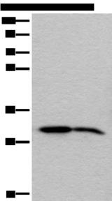 IMPA1 / IMP Antibody - Western blot analysis of Human cerebrum tissue and Mouse brain tissue lysates  using IMPA1 Polyclonal Antibody at dilution of 1:300