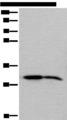IMPA1 / IMP Antibody - Western blot analysis of Human cerebrum tissue and Mouse brain tissue lysates  using IMPA1 Polyclonal Antibody at dilution of 1:300