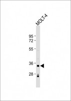 IMPA2 Antibody - Anti-IMPA2 Antibody (N-Term) at 1:2000 dilution + MOLT-4 whole cell lysate Lysates/proteins at 20 ug per lane. Secondary Goat Anti-Rabbit IgG, (H+L), Peroxidase conjugated at 1:10000 dilution. Predicted band size: 31 kDa. Blocking/Dilution buffer: 5% NFDM/TBST.