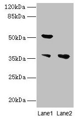 IMPACT Antibody - Western blot All lanes: IMPACT antibody at 10µg/ml Lane 1: Hela whole cell lysate Lane 2: HL60 whole cell lysate Secondary Goat polyclonal to rabbit IgG at 1/10000 dilution Predicted band size: 37, 23 kDa Observed band size: 37, 52 kDa