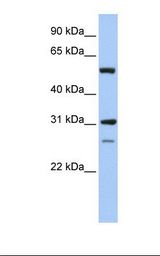 IMPDH1 Antibody - Hela cell lysate. Antibody concentration: 1.0 ug/ml. Gel concentration: 12%.  This image was taken for the unconjugated form of this product. Other forms have not been tested.