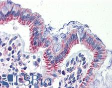 IMPDH1 Antibody - Anti-IMPDH1 antibody IHC of human colon. Immunohistochemistry of formalin-fixed, paraffin-embedded tissue after heat-induced antigen retrieval. Antibody concentration 5 ug/ml.  This image was taken for the unconjugated form of this product. Other forms have not been tested.