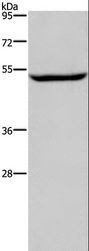 IMPDH1 Antibody - Western blot analysis of Raji cell, using IMPDH1 Polyclonal Antibody at dilution of 1:450.