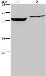 IMPDH1 Antibody - Western blot analysis of Raji and 293T cell, using IMPDH1 Polyclonal Antibody at dilution of 1:500.