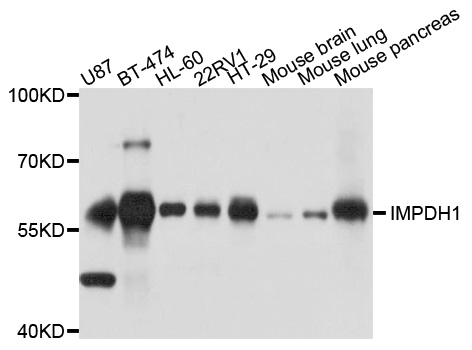 IMPDH1 Antibody - Western blot analysis of extract of various cells.