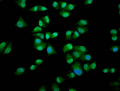 IMPDH1 Antibody - Immunofluorescence staining of Hela cells diluted at 1:200, counter-stained with DAPI. The cells were fixed in 4% formaldehyde, permeabilized using 0.2% Triton X-100 and blocked in 10% normal Goat Serum. The cells were then incubated with the antibody overnight at 4°C.The Secondary antibody was Alexa Fluor 488-congugated AffiniPure Goat Anti-Rabbit IgG (H+L).