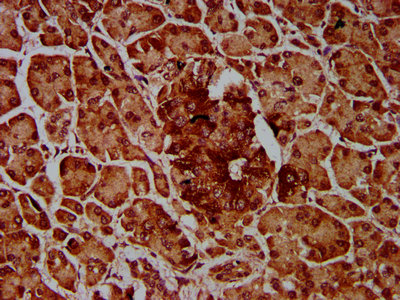 IMPDH1 Antibody - Immunohistochemistry Dilution at 1:600 and staining in paraffin-embedded human pancreatic tissue performed on a Leica BondTM system. After dewaxing and hydration, antigen retrieval was mediated by high pressure in a citrate buffer (pH 6.0). Section was blocked with 10% normal Goat serum 30min at RT. Then primary antibody (1% BSA) was incubated at 4°C overnight. The primary is detected by a biotinylated Secondary antibody and visualized using an HRP conjugated SP system.