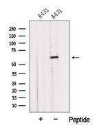 IMPDH1 Antibody - Western blot analysis of extracts of 3T3 cells using IMPDH1 antibody. The lane on the left was treated with blocking peptide.