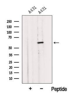 IMPDH1 Antibody - Western blot analysis of extracts of 3T3 cells using IMPDH1 antibody. The lane on the left was treated with blocking peptide.