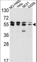 IMPDH2 Antibody - Western blot of IMPDH2 Antibody in NCI-H460,HeLa,MCF7,A2058 cell line lysates(35 ug/lane). IMPDH2 (arrow) was detected using the purified antibody.