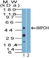 IMPDH2 Antibody - Western Blot: IMPDH2 Antibody - Analysis of IMPDH using IMPDH antibody. Jurkat cell lysate in the 1) absence and 2) presence of immunizing peptide probed with 2 ug/ml of IMPDH antibody. Goat anti-rabbit Ig HRP secondary antibody and PicoTect ECL substrate solution were used for this test.