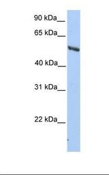 IMPDH2 Antibody - HepG2 cell lysate. Antibody concentration: 1.0 ug/ml. Gel concentration: 12%.  This image was taken for the unconjugated form of this product. Other forms have not been tested.
