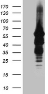 IMPDH2 Antibody - HEK293T cells were transfected with the pCMV6-ENTRY control. (Left lane) or pCMV6-ENTRY IMPDH2. (Right lane) cDNA for 48 hrs and lysed
