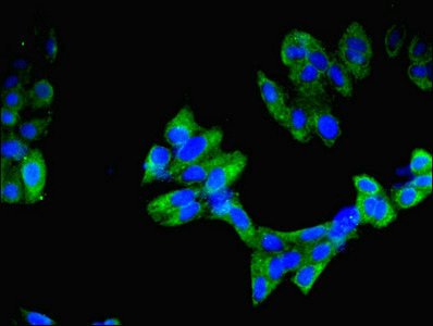 IMPDH2 Antibody - Immunofluorescent analysis of Hela cells using IMPDH2 Antibody at dilution of 1:100 and Alexa Fluor 488-congugated AffiniPure Goat Anti-Rabbit IgG(H+L)