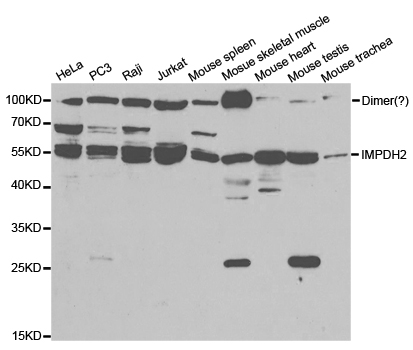 IMPDH2 Antibody - Western blot analysis of extracts of various cell lines.