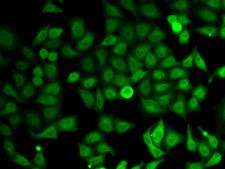 IMPDH2 Antibody - Immunofluorescence analysis of HeLa cells.