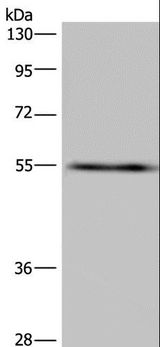 IMPDH2 Antibody - Western blot analysis of A549 cell, using IMPDH2 Polyclonal Antibody at dilution of 1:650.