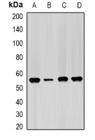 IMPDH2 Antibody - Western blot analysis of IMPDH2 expression in HeLa (A); PC3 (B); mouse spleen (C); mouse heart (D) whole cell lysates.