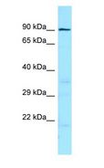 IMPG1 Antibody - IMPG1 antibody Western Blot of HepG2.  This image was taken for the unconjugated form of this product. Other forms have not been tested.