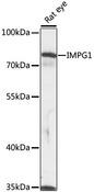 IMPG1 Antibody - Western blot analysis of extracts of rat eye using IMPG1 Polyclonal Antibody at dilution of 1:1000.