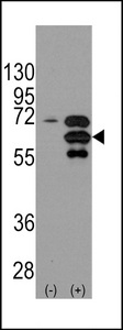 INA / Alpha Internexin Antibody - Western blot of INA (arrow) using rabbit polyclonal INA Antibody. 293 cell lysates (2 ug/lane) either nontransfected (Lane 1) or transiently transfected with the INA gene (Lane 2) (Origene Technologies).