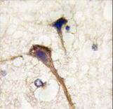 INA / Alpha Internexin Antibody - Formalin-fixed and paraffin-embedded human brain tissue reacted with INA antibody , which was peroxidase-conjugated to the secondary antibody, followed by DAB staining. This data demonstrates the use of this antibody for immunohistochemistry; clinical relevance has not been evaluated.
