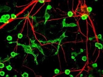 INA / Alpha Internexin Antibody - Immunofluorescent staining using INA antibody. Immunofluorescent staining of cultured neurons and glia showing specific labeling of neuronal processes (red) using alpha-internexin antibody and microglia (green) with a coronin 1a antibody