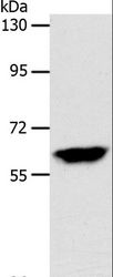 INA / Alpha Internexin Antibody - Western blot analysis of Mouse brain tissue, using INA Polyclonal Antibody at dilution of 1:500.
