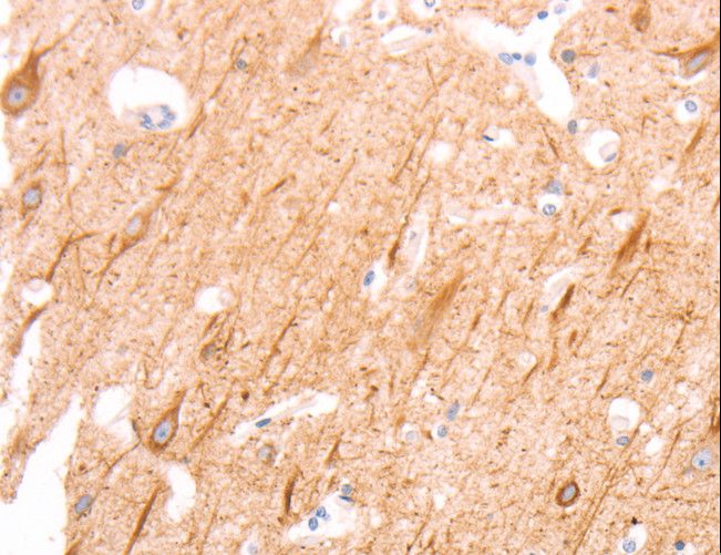 INA / Alpha Internexin Antibody - Immunohistochemistry of paraffin-embedded Human brain using INA Polyclonal Antibody at dilution of 1:25.